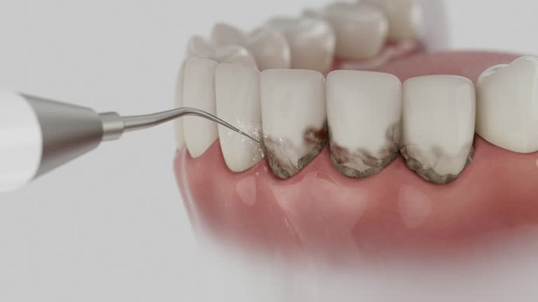 Reliable Emergency Dentist contractor in Clermont, GA by Smile Center Dentistry